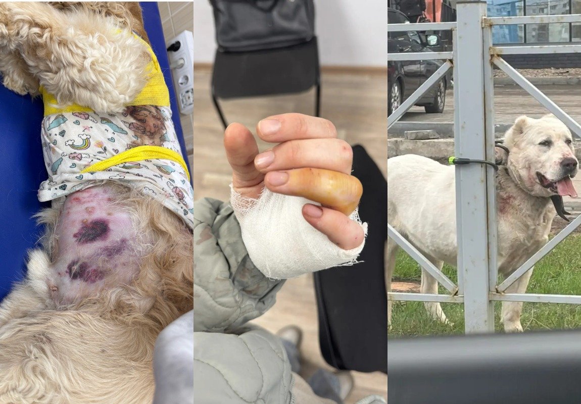 На детской площадке в Ижевске алабай напал на спаниеля и прокусил руку его хозяйке