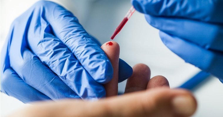 Одиннадцать мобильных пунктов тестирования на ВИЧ-инфекцию заработают в Удмуртии 30 ноября
