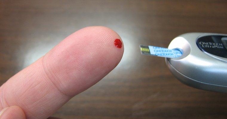 Удмуртия впервые закупила для льготников тест-полоски на измерение уровня глюкозы в крови