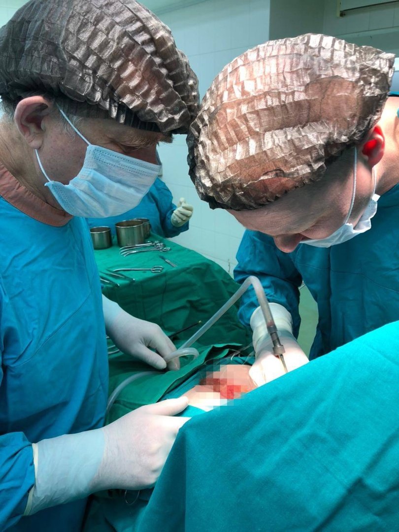 Хирурги Ижевска прооперировали бойца СВО и извлекли два осколка 