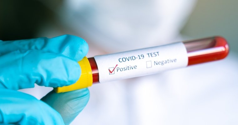 Первые случаи коронавируса зарегистрировали в Юкаменском и Кизнерском районах Удмуртии