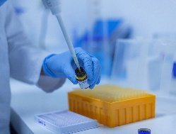 Ещё 298 новых случаев заболевания коронавирусом выявили в Удмуртии