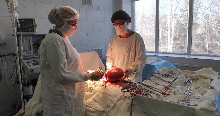 Шестикилограммовую миому успешно удалили хирурги ГКБ №6 Ижевска