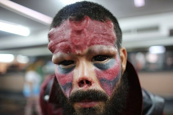 Ради сходства с любимым персонажем комиксов житель Венесуэлы отрезал себе нос