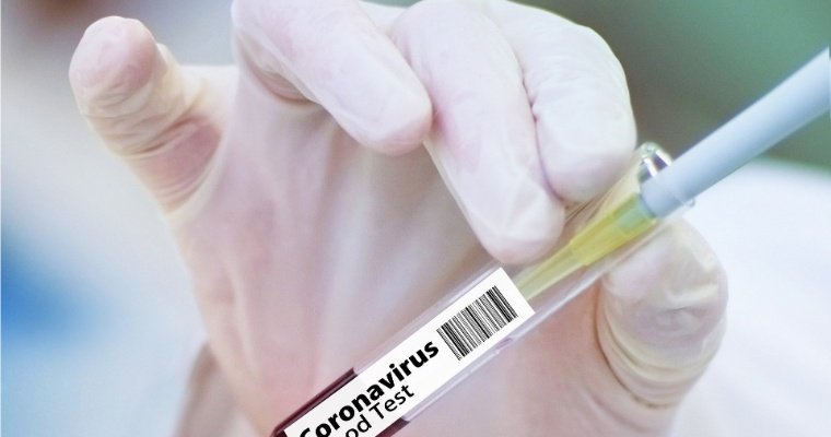 В страны Евросоюза поступит 300 млн доз вакцины от коронавируса