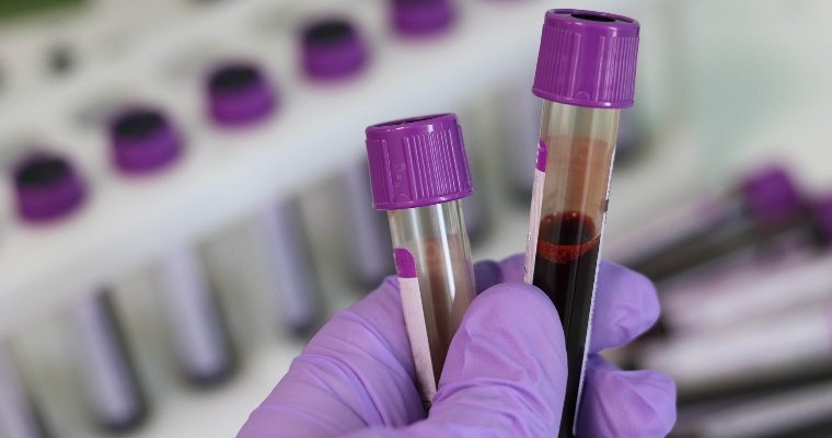В Удмуртии зафиксировали 9 новых случаев заражения коронавирусом