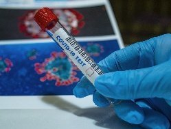 Еще 19 случаев коронавируса выявили в Удмуртии