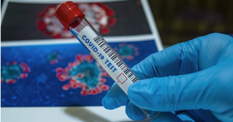 Еще 19 случаев коронавируса выявили в Удмуртии