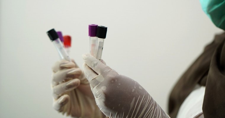В Удмуртии среди пациентов с коронавирусом произошло семь летальных случаев