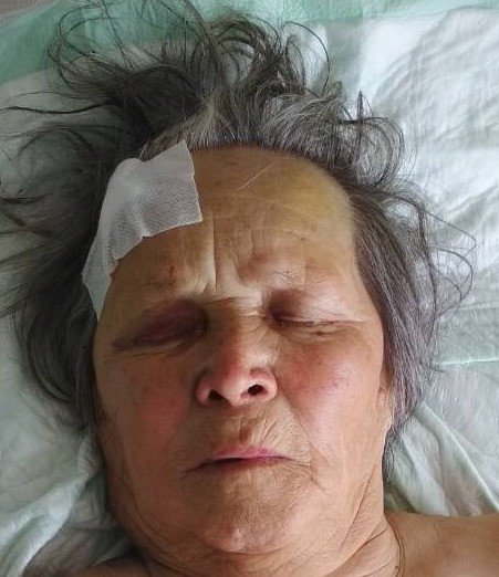 В Ижевске разыскивают родственников пострадавшей в ДТП пенсионерки