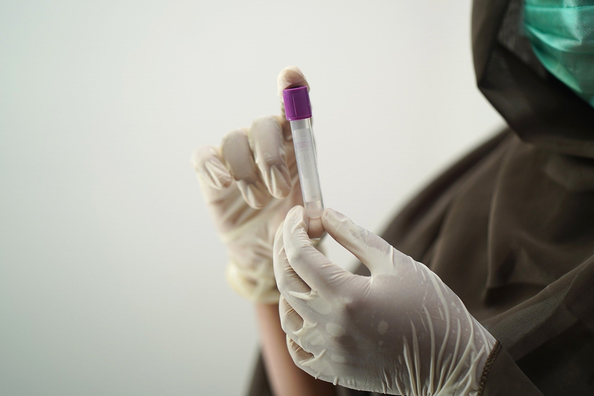 

Еще 95 случаев заражения коронавирусом выявили в Удмуртии

