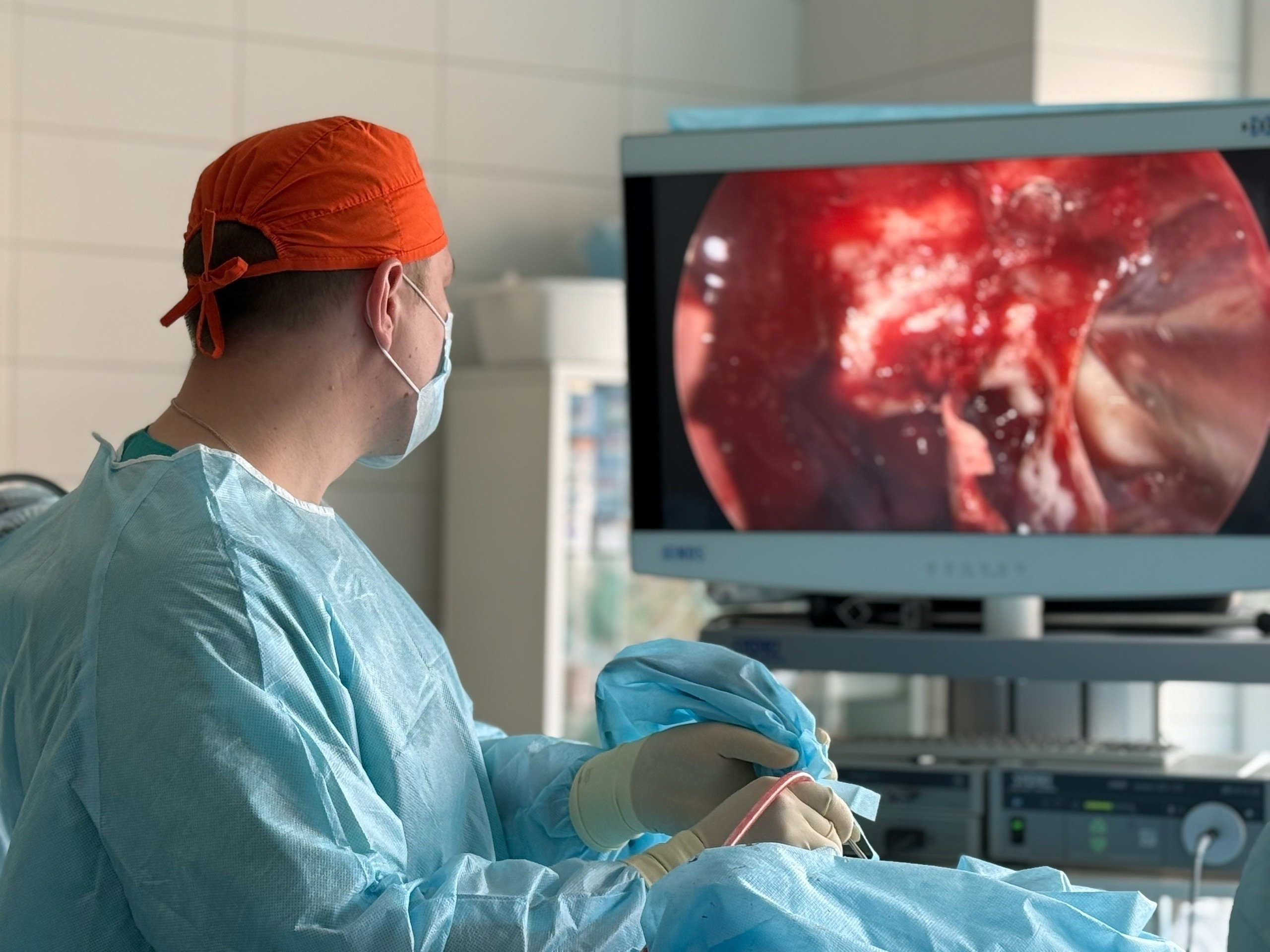 Операцию по удалению опухоли в головном мозге провели врачи 1 РКБ в Ижевске