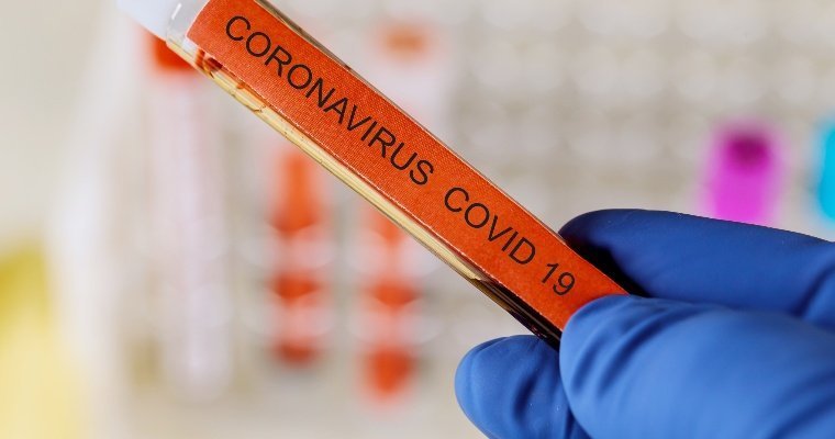 Еще 20 жителей Удмуртии заразились коронавирусом