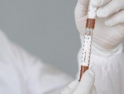 В Удмуртии выявили еще 25 случаев заражения коронавирусом