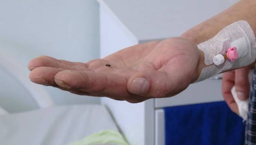 Хирурги Ижевска извлекли осколок гранаты из ноги участника СВО