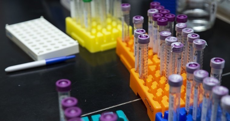 Жителям Удмуртии разъяснили порядок действий при получении из частной лаборатории положительного анализа на коронавирус