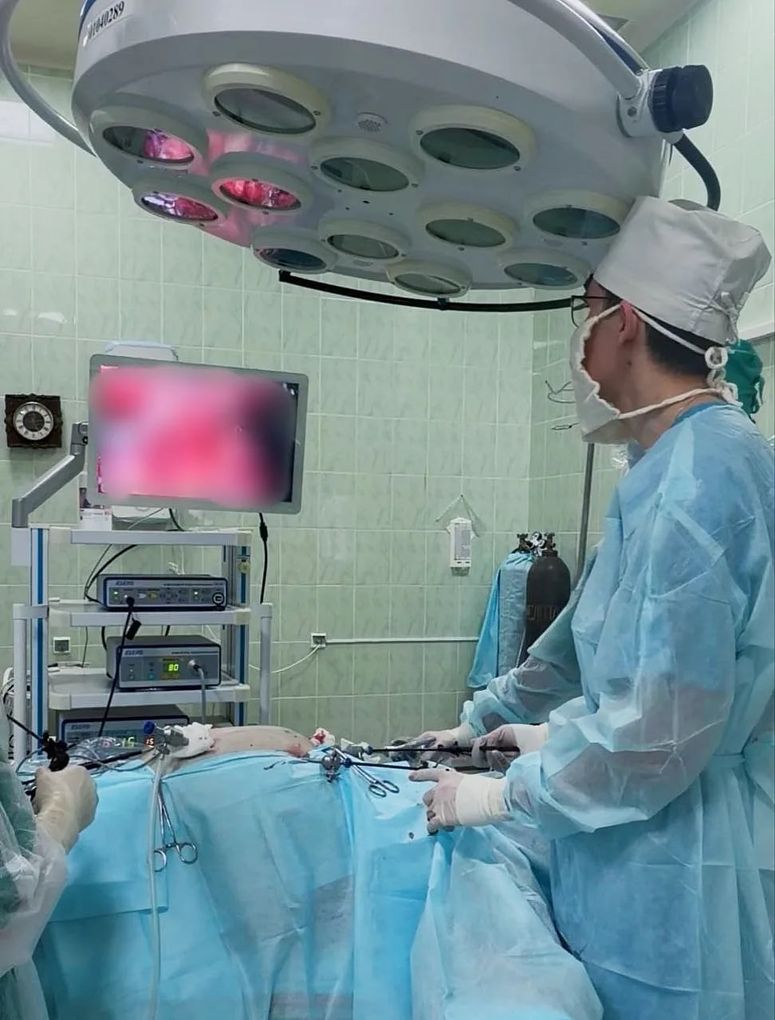 Хирурги в Сарапуле применили новую методику для лечения пупочный грыжи