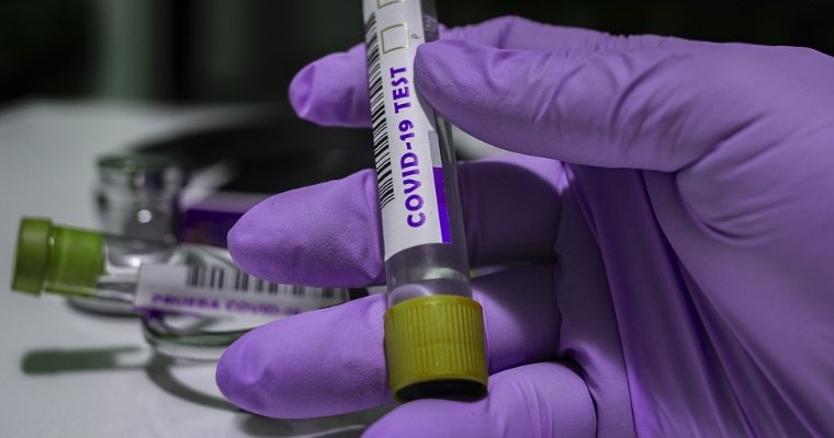 Мошенники предлагают жителям Удмуртии пройти платные тесты на коронавирус
