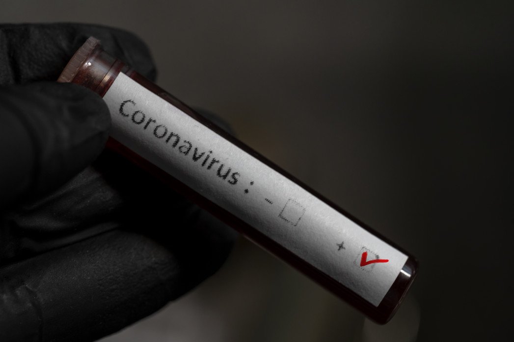 

Более 300 вернувшихся в Удмуртию туристов не предоставили результаты тестов на коронавирус

