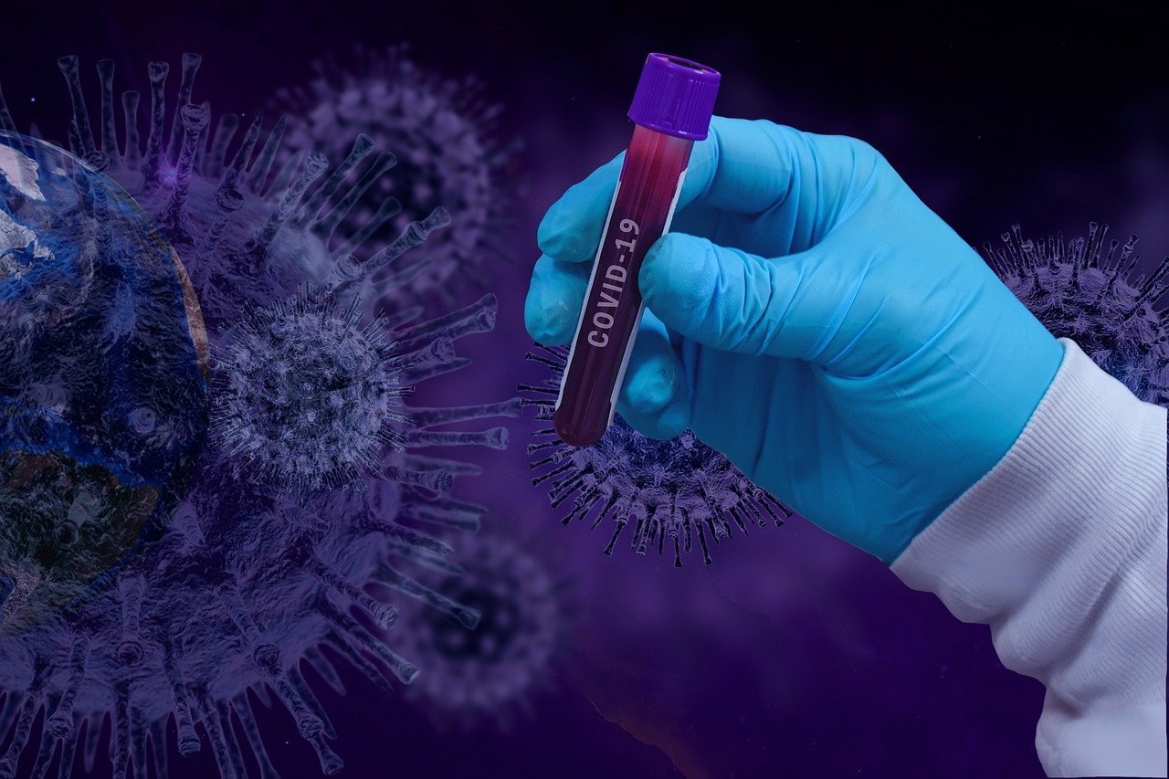

За сутки в Удмуртии коронавирус выявили у 77 человек

