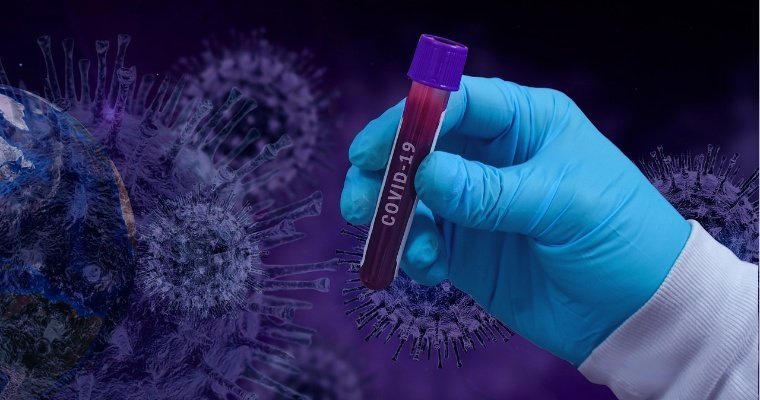 За сутки в Удмуртии коронавирус выявили у 77 человек
