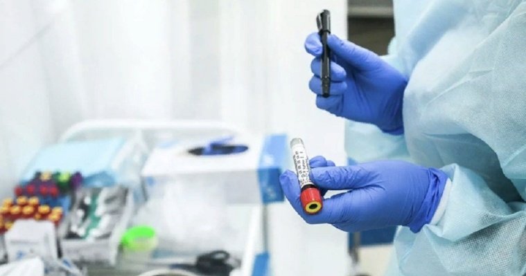 В Удмуртии выявили еще 74 случая коронавируса