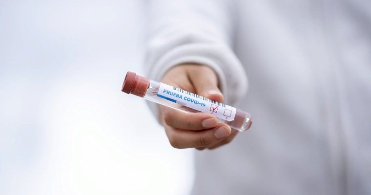 В Удмуртии за сутки выявили 45 случаев коронавируса