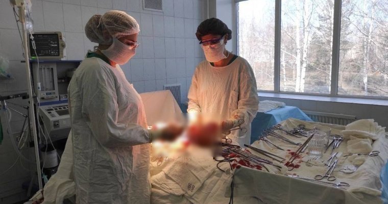 Кисту яичника успешно удалили хирурги Ижевска