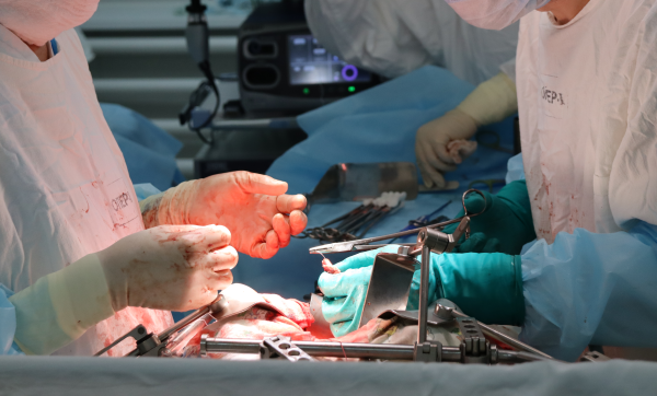 Ижевские хирурги удалили у 58-летнего пациента опухоль пищевода  