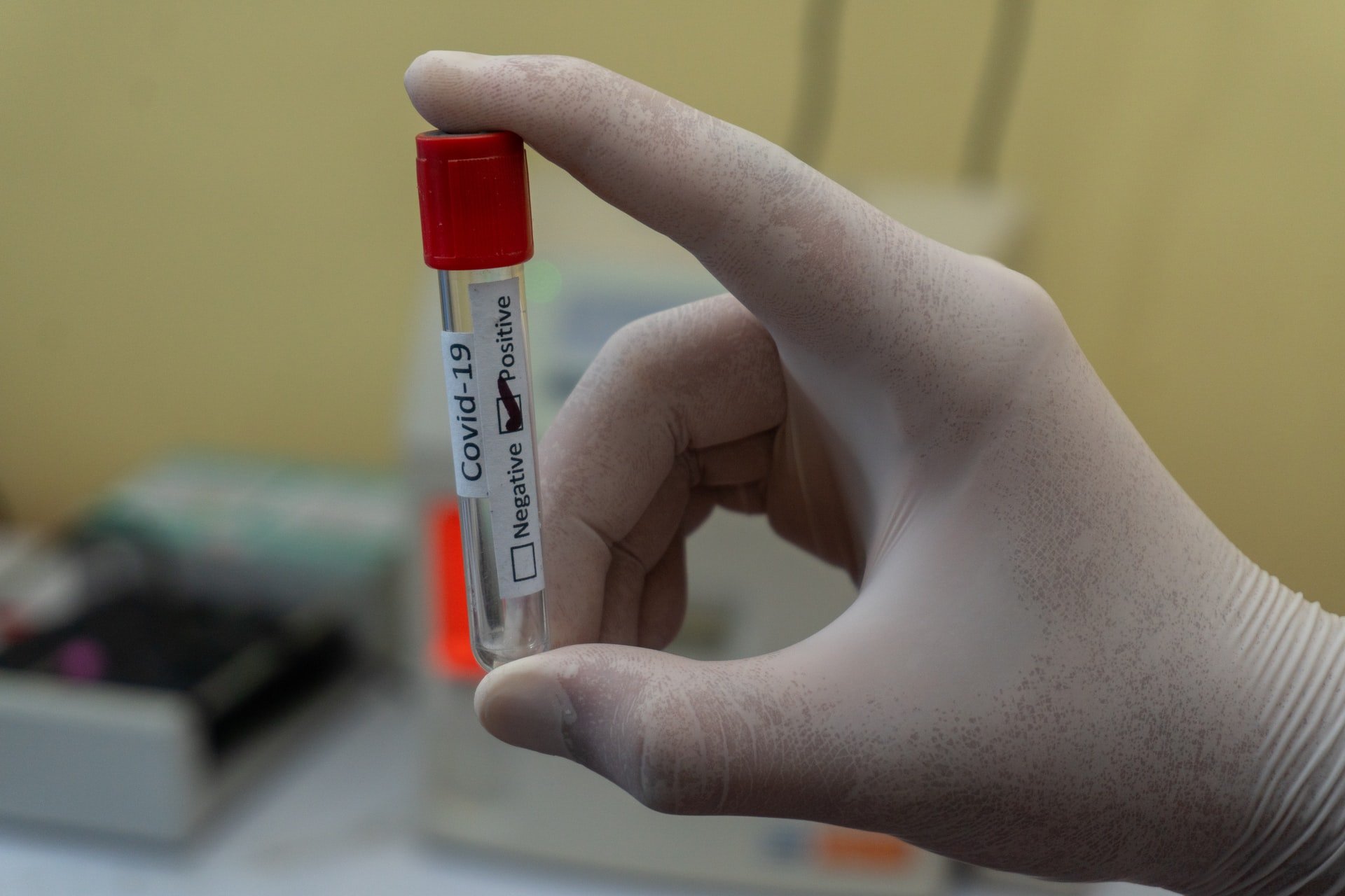 

В Удмуртии увеличилось время получения результатов теста на коронавирус

