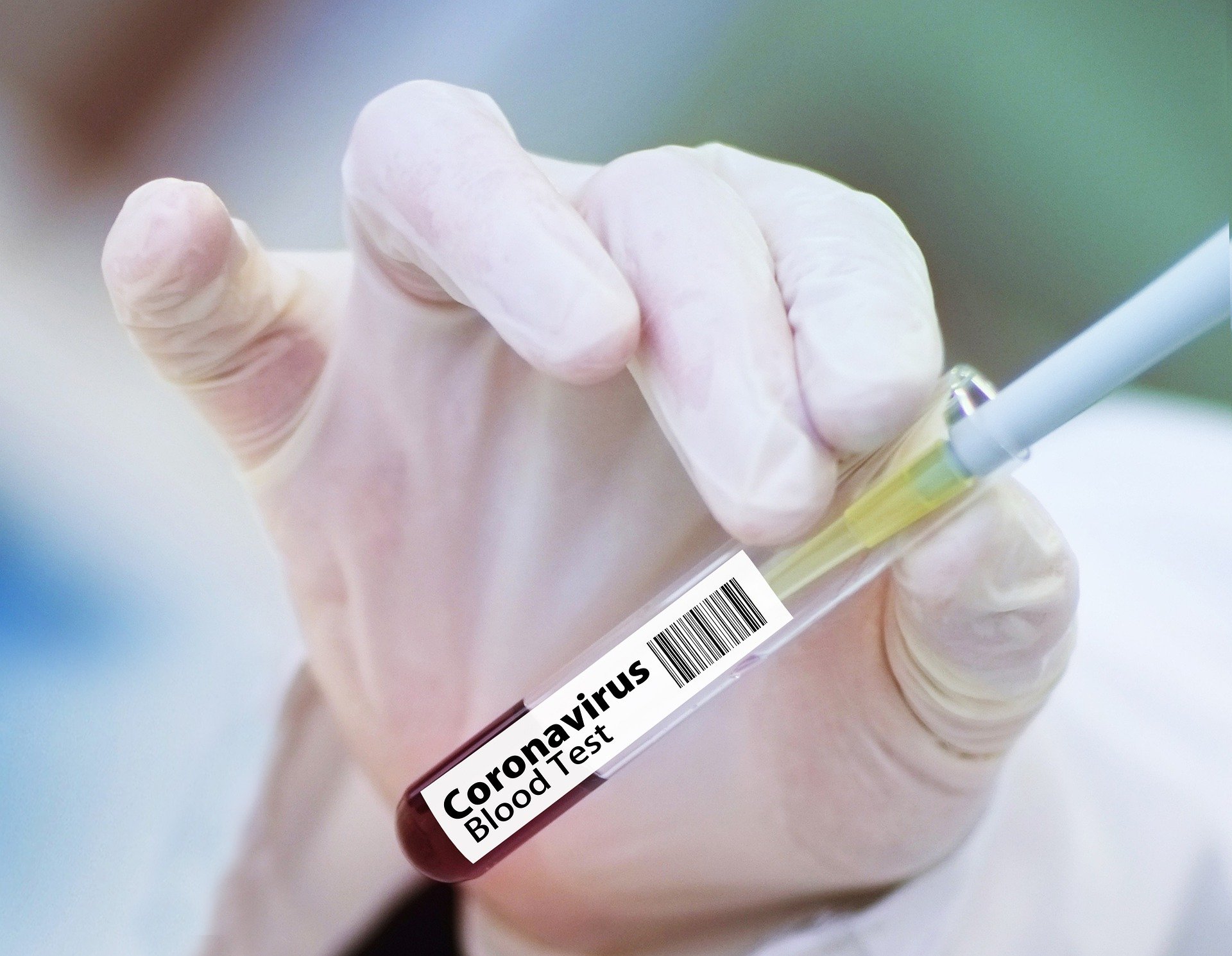 В Удмуртии выявили 44 новых случая заражения коронавирусом