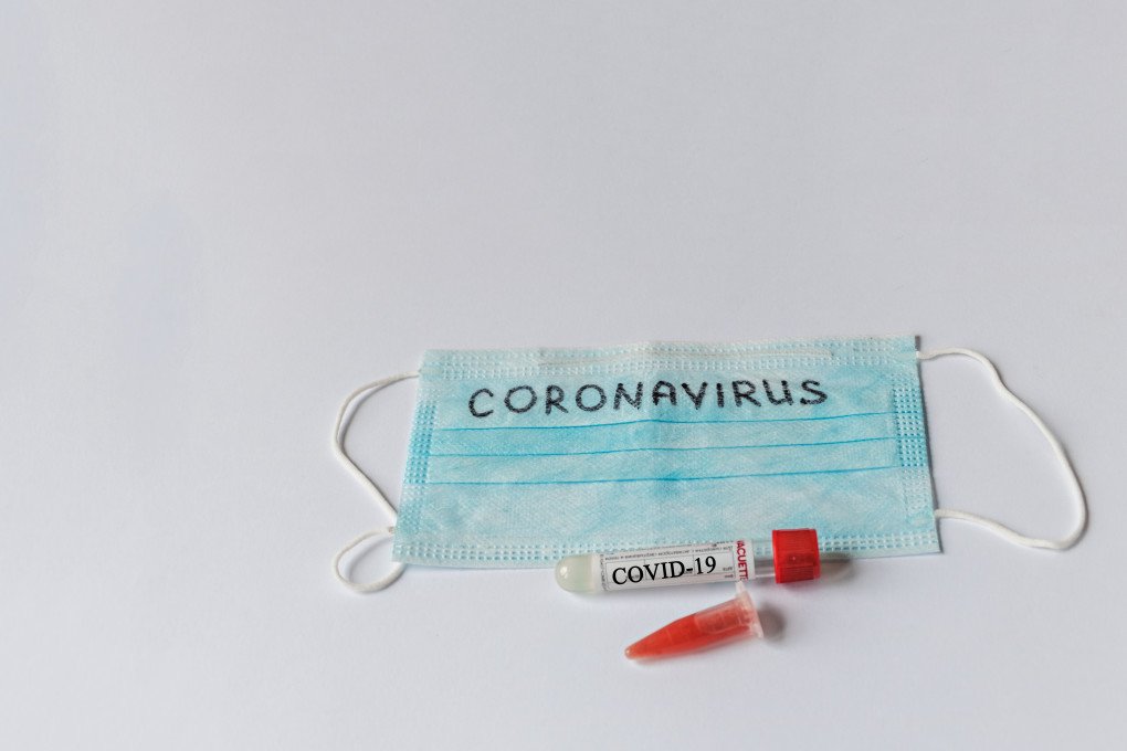 

Пожилой мужчина с подтвержденным коронавирусом скончался в Удмуртии

