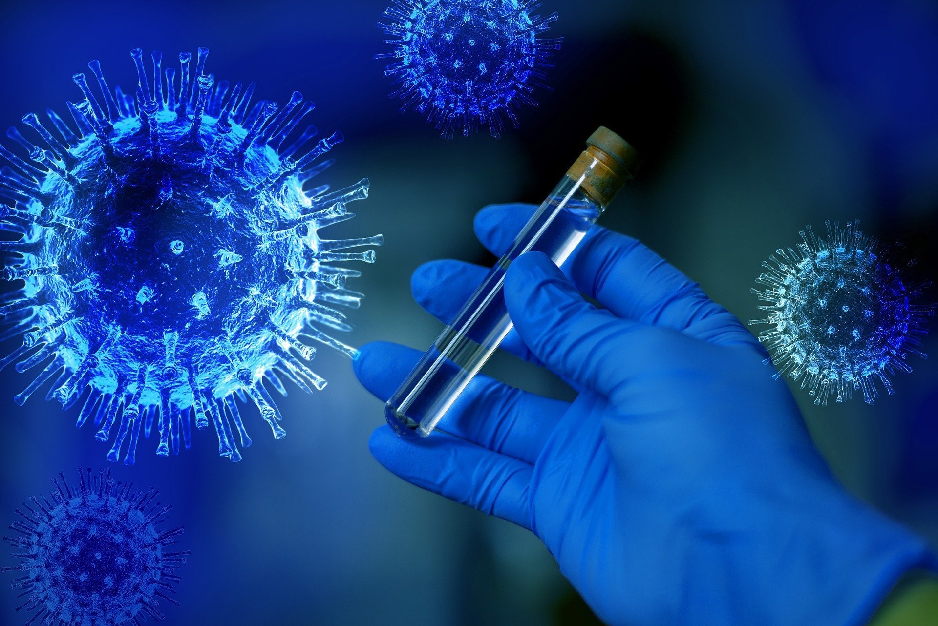 Еще 19 случаев заражения коронавирусом выявили в Удмуртии
