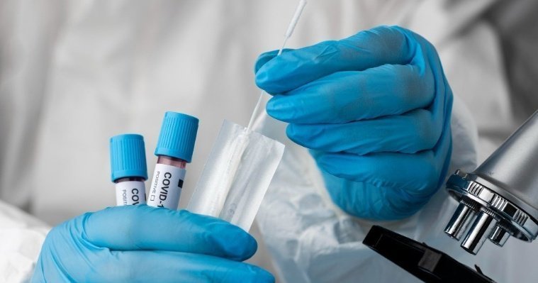 В Удмуртии за сутки коронавирус обнаружили у 665 человек