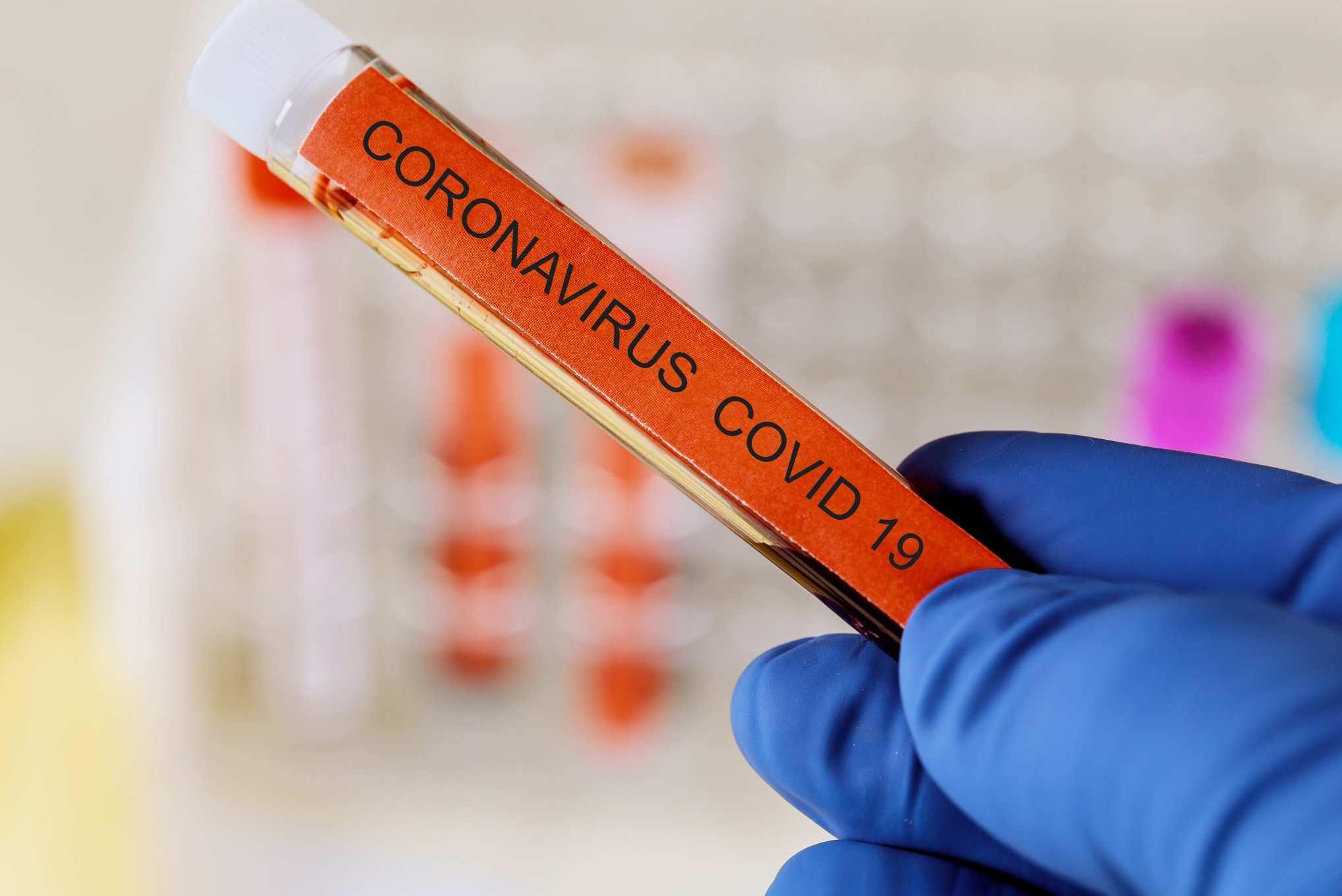В Удмуртии за сутки выявили 53 новых случая заболевания коронавирусом