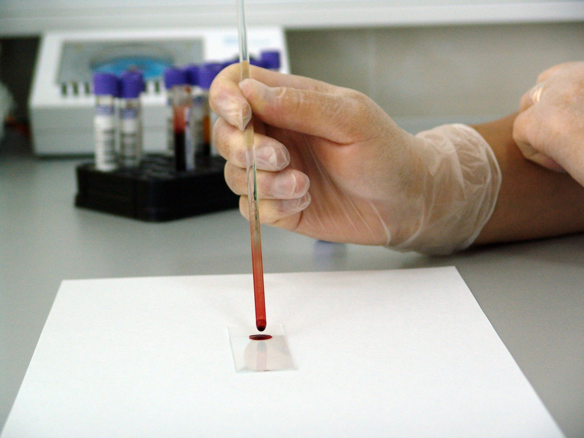 Тест на 13 видов рака по одной капле крови разработали в Японии